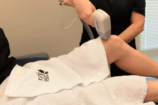 Actual patient getting laser hair reduction treatment at Nuance Facial Plastics